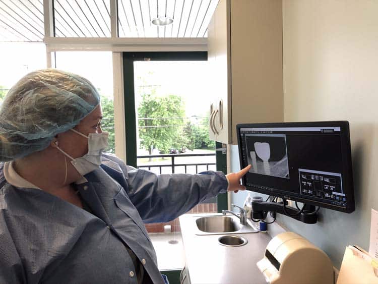 Dental implant X-ray review at Dr. Weiss Dentistry in Cockeysville MD